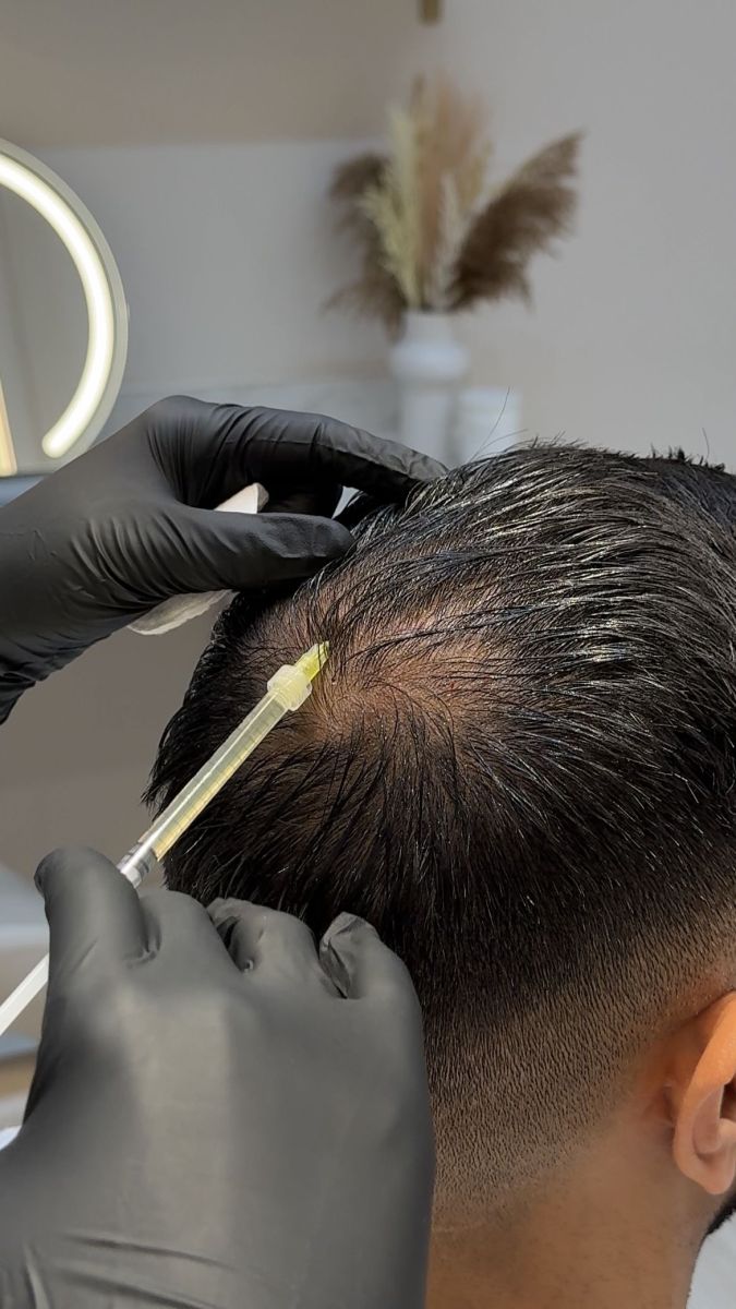 Lý do nam giới bị rụng tóc